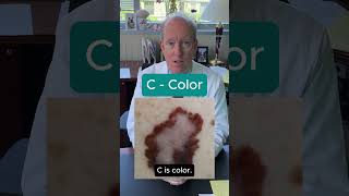 Download lagu Is it a Mole or Melanoma? mp3 Download lagu Is it a Mole or Melanoma? mp3