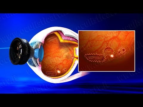 Da pelle di faccia flaccida Tipi e le ragioni di hypostases sotto occhi