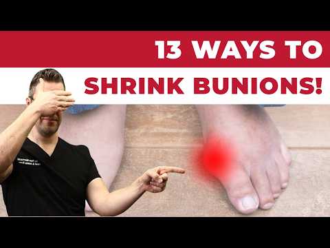 TOP 13 Ways to Shrink Bunions Naturally [+1 HUGE SECRET!]