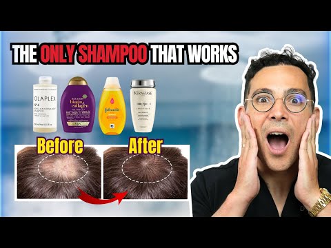 What is the Best Shampoo for Hair Loss? Doctor Reveals the Truth