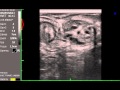DRAMIŃSKI 4Vet Mini Jajnik Z Pecherzykami Jajnikowymi Ovary To The Ovarian Vesicles