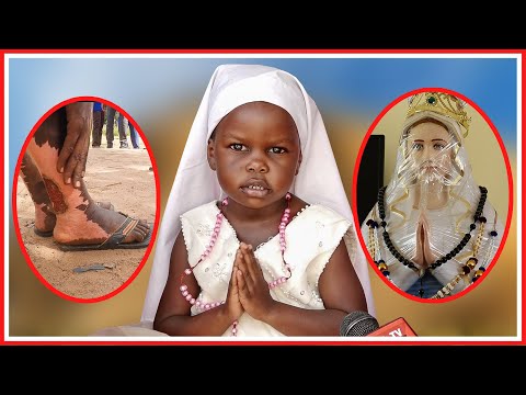 WACHAWI WAJARIBU KUMUUA MTOTO YUNIS MARA 2, APONYA WAGONJWA KUTOKA ULAYA, APEWA ZAWADI YA VATICAN..