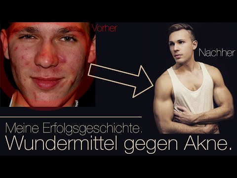 Keine Spermien in Prostata-Adenom Prostatakrebs ist der Fliegenpilz