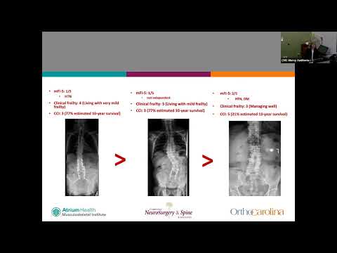 How, when, and what to consider: surgical intervention of adult spinal deformity Ainsley Bloomer MD