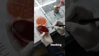 culture prepration for bacteria growth in blood agar,🥵