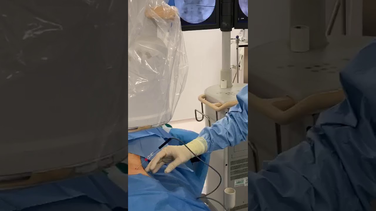 Watch Now Ernia del disco L4-L5 rimossa con il laser in anestesia locale Ernia del disco L4-L5 rimossa con il laser in anestesia locale