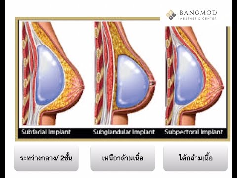 ที่เล็กที่สุดสาวหน้าอก การออกกำลังกายเพื่อขยายขนาดเต้านม