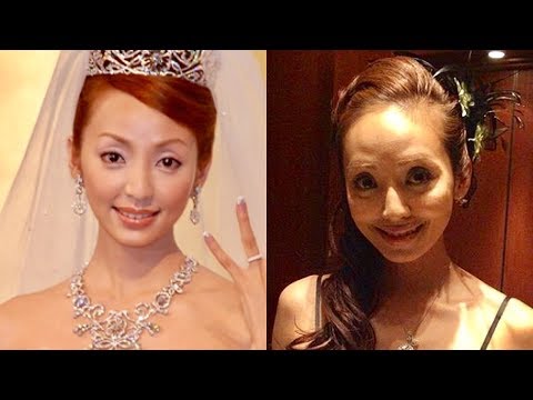 セレーナ・ゴメス、整形疑惑に反論も美容整形は認めた