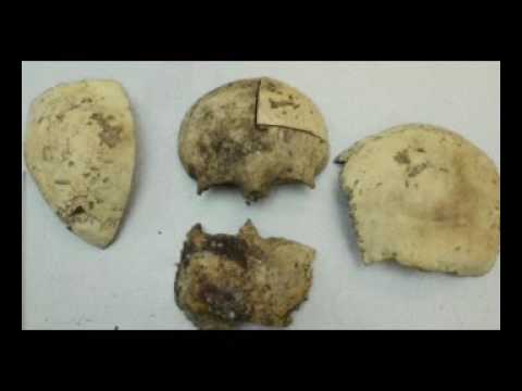 New Homeowners Find Human Remains in Attic