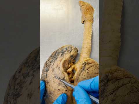 Lungs the Size of a Tennis Court!? #breathing #lungs