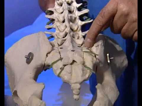 Herniation der Lenden Behandlung Homöopathie Laden an der sacro-lumbalen Osteochondrose