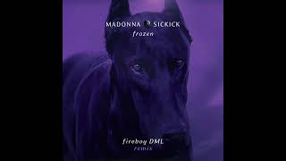 Madonna x Sickick - Frozen (Fireboy DML Remix) [Official Audio]