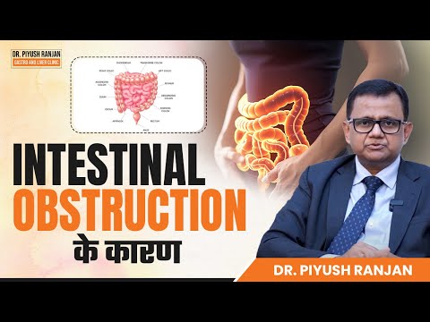 Intestinal Obstruction के कारण | Best Treatment For Intestinal Obstruction | Dr. Piyush Ranjan
