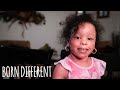The Little Girl Whose Skin Grows Too Fast BORN DIFFERENT