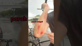 Download lagu I just had an accident.. mp3