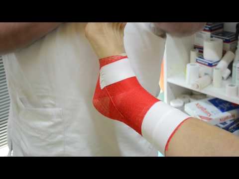 La terapia a base di erbe in dolori articolari Ginocchio protesi articolari Stryker