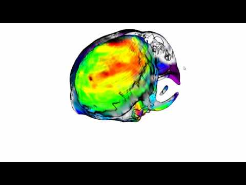 Olio di pesce finlandese per le articolazioni Crema ketonal con osteocondrosi della colonna cervicale