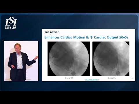 William Altman, CorInnova - Minimally invasive cardiac assist for acute heart failure | LSI USA '26