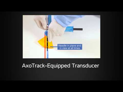 Sonosite AxoTrack® Needle Guidance Technology Part 4: How AxoTrack is Unique