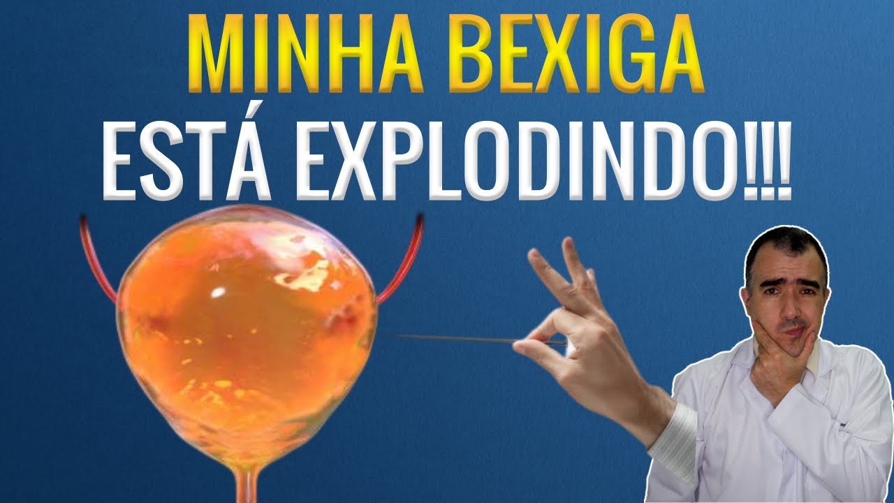Sensação de bexiga cheia: Como isso incomoda, Doutor!!!