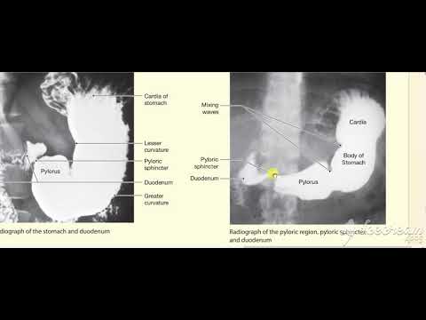 Stomache radiology