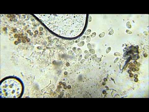 Crema di decolorazione di faccia di welltex Sbatta un bene fino a rendere cremoso da abbronzatura e lentiggini