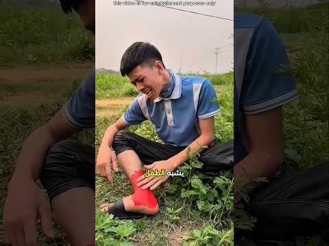 شفي الشاب بفضل الحيوان 😮 #shorts