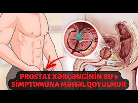 Mit kell inni a fájdalom a prostatitis