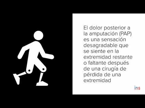 Dolor posterior a la amputación