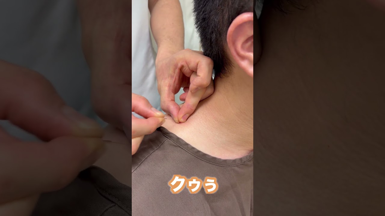 本当の肩コリ鍼灸はこれ！