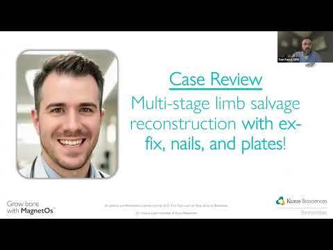 FootInnovate Debate Recording - "Hardware, Biology, or Biologics: What Really Drives Fusion?"