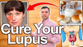 LUPUS NEVER AGAIN - How To Treat Lupus Naturally - Eliminate Lupus Symptoms and Autoimmune Reactions