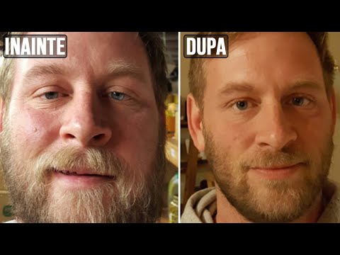 Ce Se Intampla Cu CORPUL Tau Cand NU Mai Bei ALCOOL