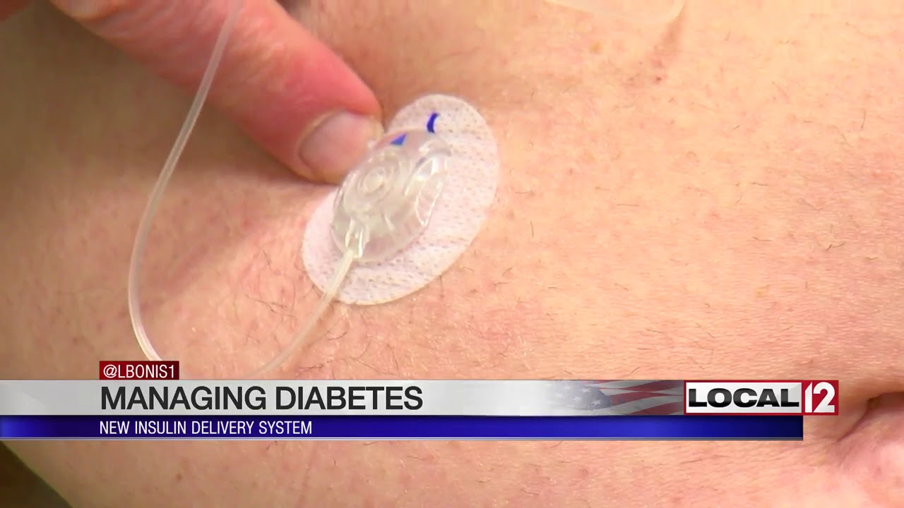 New insulin delivery system helps local man better manage diabetes