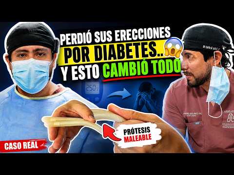 Experiencia médica en el Centro de Prótesis Peniana