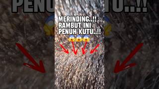 Download lagu Rambut Penuh Kutu! Bikin Merinding Banget? 😱 #reaction #short #shorts mp3 Download lagu Rambut Penuh Kutu! Bikin Merinding Banget? 😱 #reaction #short #shorts mp3