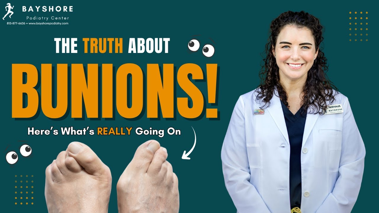 Bunion Pain? The TRUTH Every Woman Should Know | Dr. Niehaus Explains the REAL Cause & Fixes