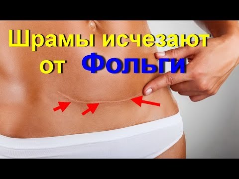 Санатории лечения позвоночников Спазмы мышц спины лечение
