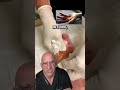 Listen for the POP 🔊DUPUYTREN’S Contracture Quick Fix #shorts