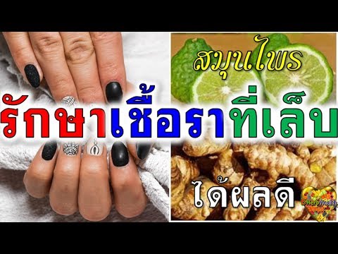 ปลา Garra rufa รักษาการจัดอันดับของโรคสะเก็ดเงิน ที่อาศัยอยู่ในน้ำโรคสะเก็ดเงิน