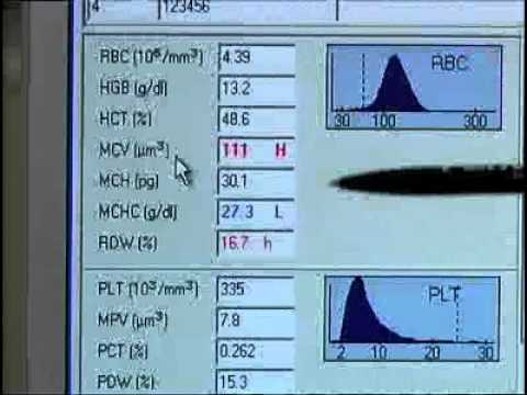 Part of a video titled How to Use a Blood Analyser | William Armour - YouTube
