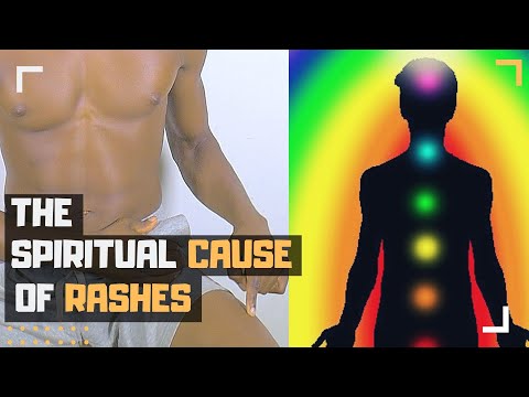 download lagu mp3 mp4 Spiritual Meaning Of Skin Rash, download lagu Spiritual Meaning Of Skin Rash gratis, unduh video klip Spiritual Meaning Of Skin Rash