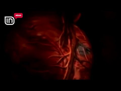 Studimi. Një në dhjetë 50-vjeçarë e ka zemrën 10 vjet më të vjetër, se mosha që ka