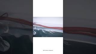 Treating gangrene or diabetic foot without amputation | Atherectomy | 3D animation | Dr. Gaurav G.