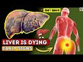 LIVER is DYING! 12 Weird Signs of Liver Damage | signs of liver damage!