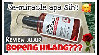 Download lagu REVIEW PEMAKAIAN 4 BULAN SNAIL TRUECICA MIRACLE REPAIR SERUM | SOMEBYMI mp3
