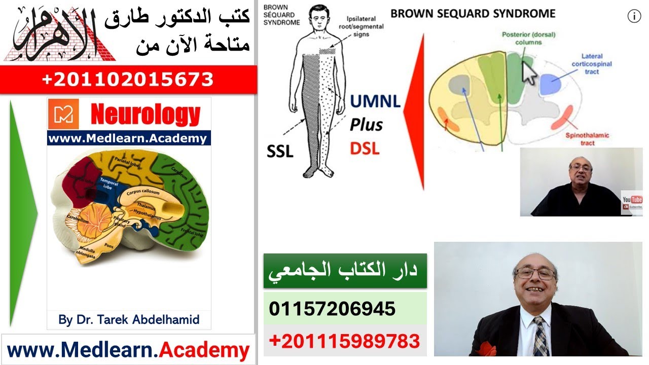 Localisation of Neurological Lesions (Part 2)