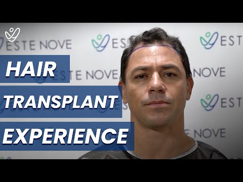 Best Hair Transplant #Turkey / Experience of Marcus and Andreas from America