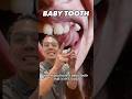 How To Safely Treat A Loose Tooth In Office To Hands On Dental Training Shorts