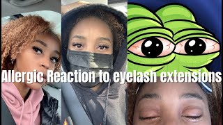 Sit down: Allergic reaction to eyelash extensions, what to do in detail